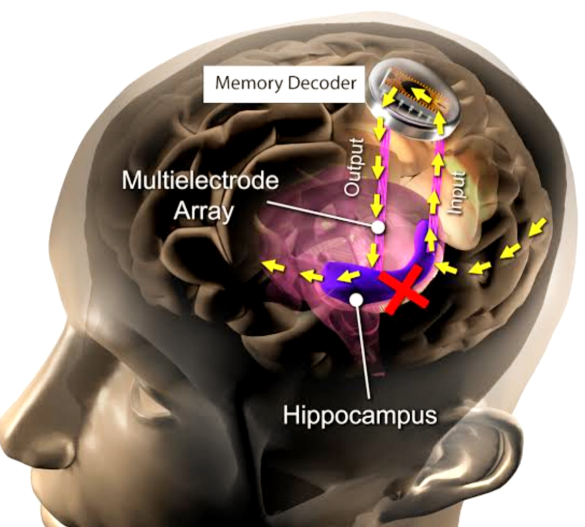Neuralink