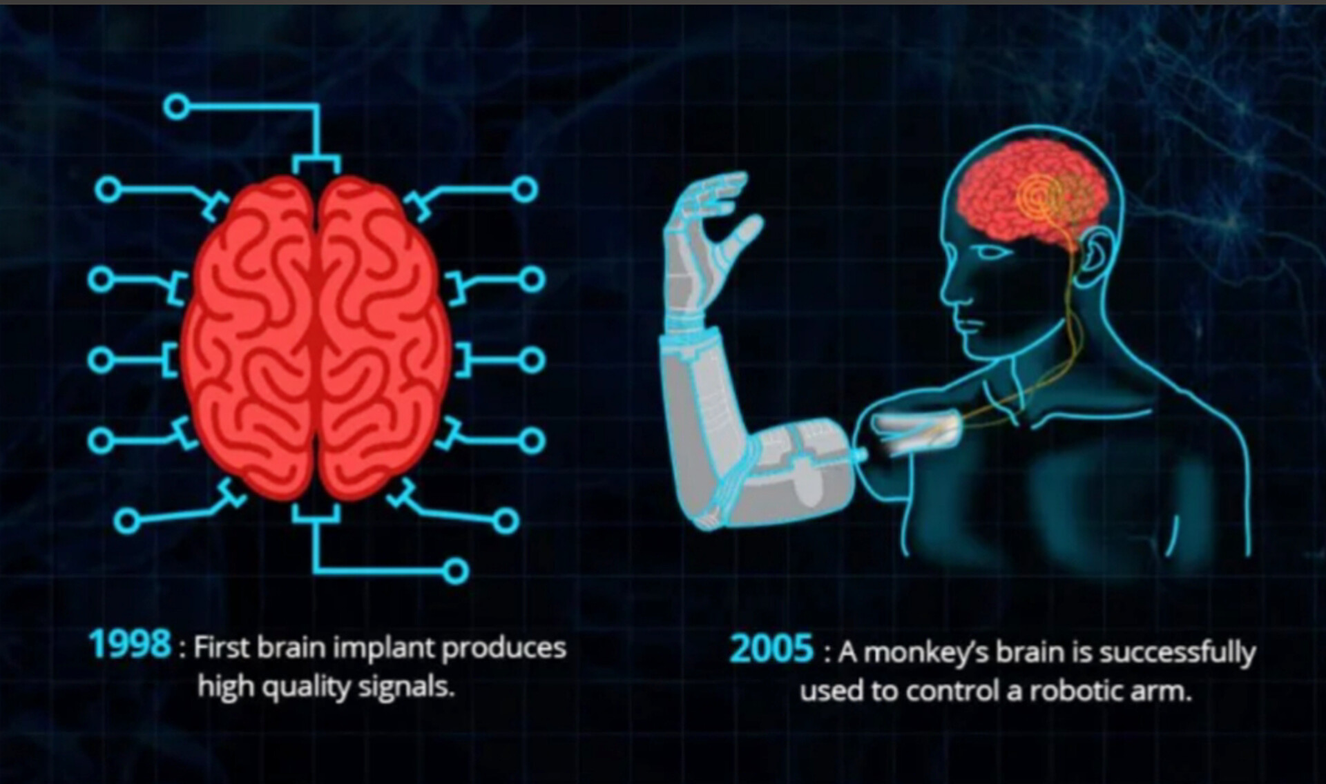 Neuralink