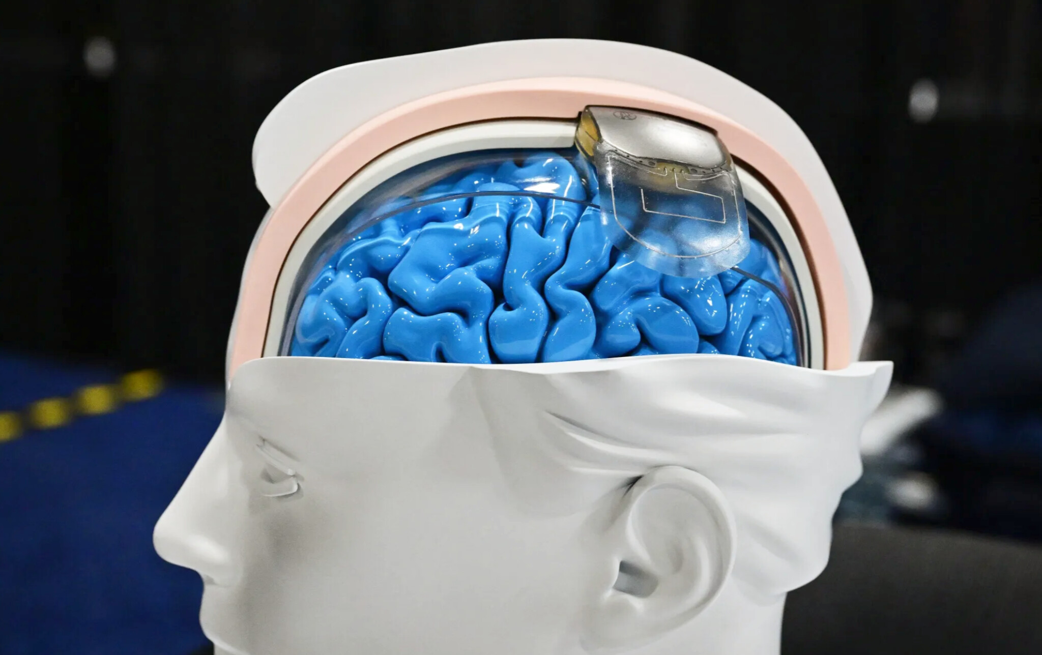 Brain 
