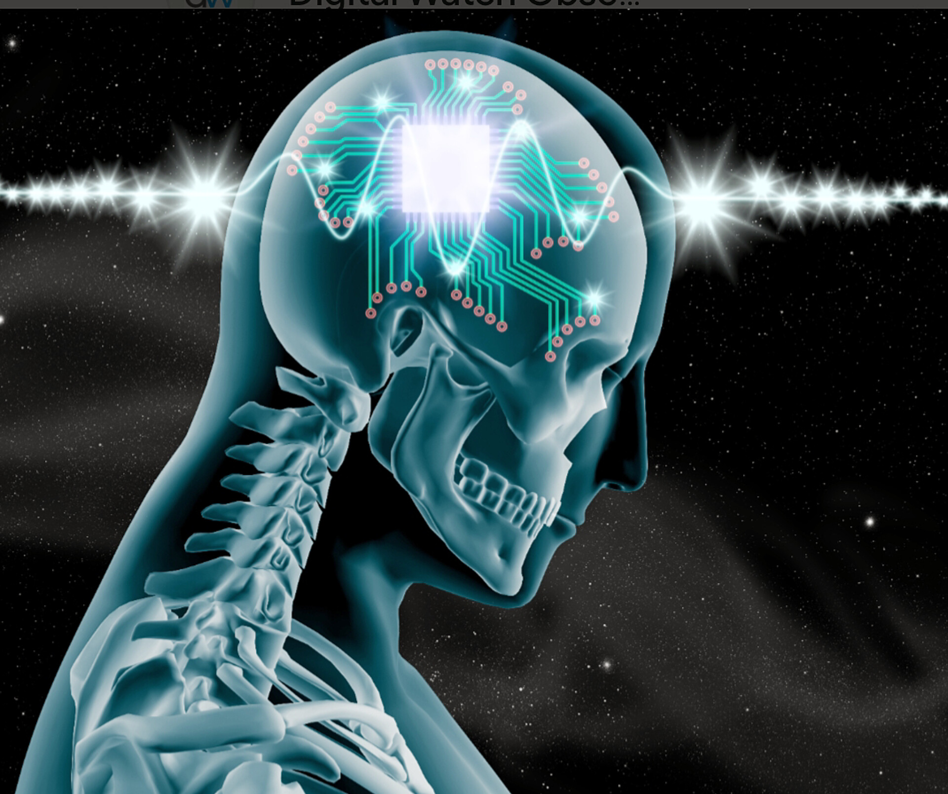 Brain 